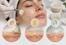 مقایسه لایه‌برداری فیزیکی، آنزیمی و اسیدی در فیشیال